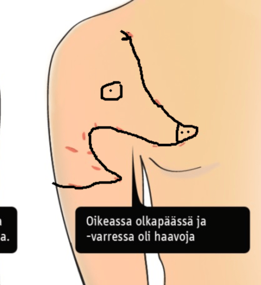 Saatanalla mielensä saastuttamaton nettikirjoittaja yhdistää pistojäljet eri tavalla 